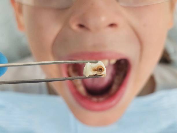 Best Weekend Emergency Dentist in Great Falls, VA